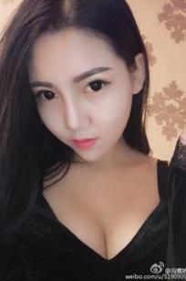冯雪娇SIR
